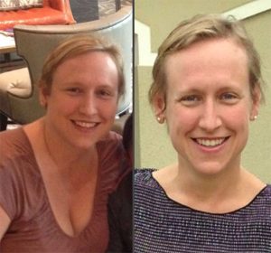 Alyssa Wilson Leggoe Before and After